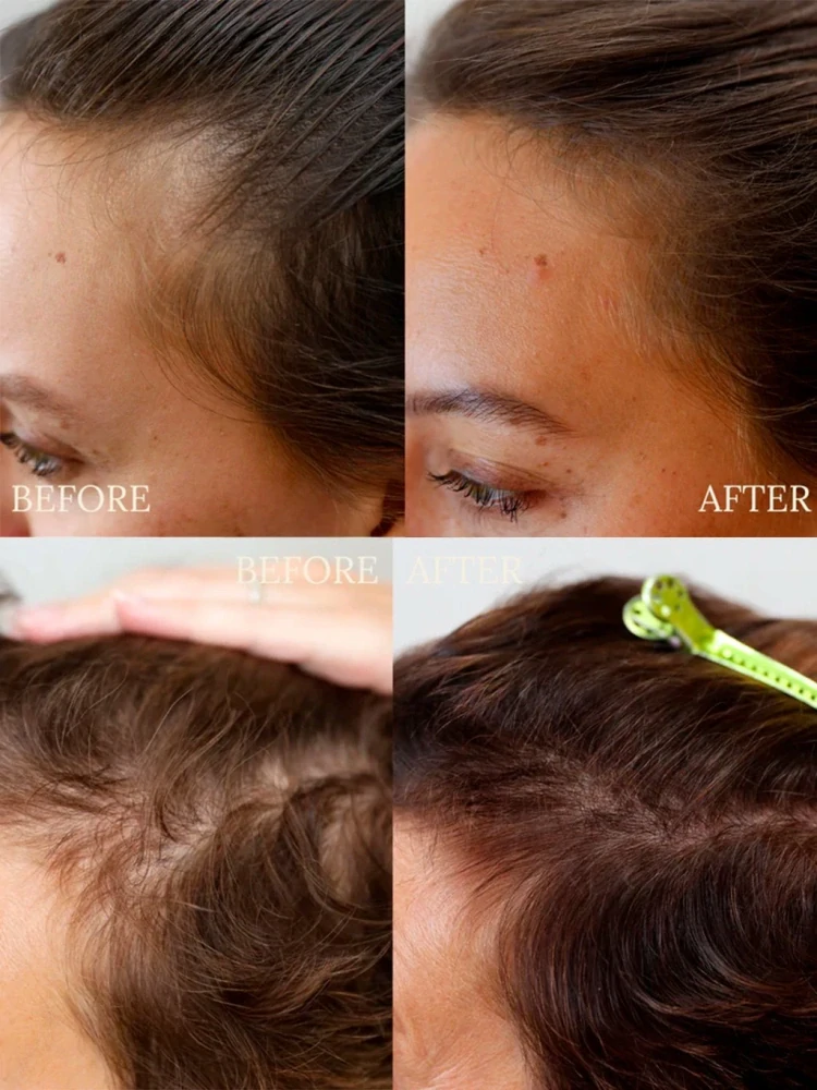 Anti Hair Loss Duo, set produktů